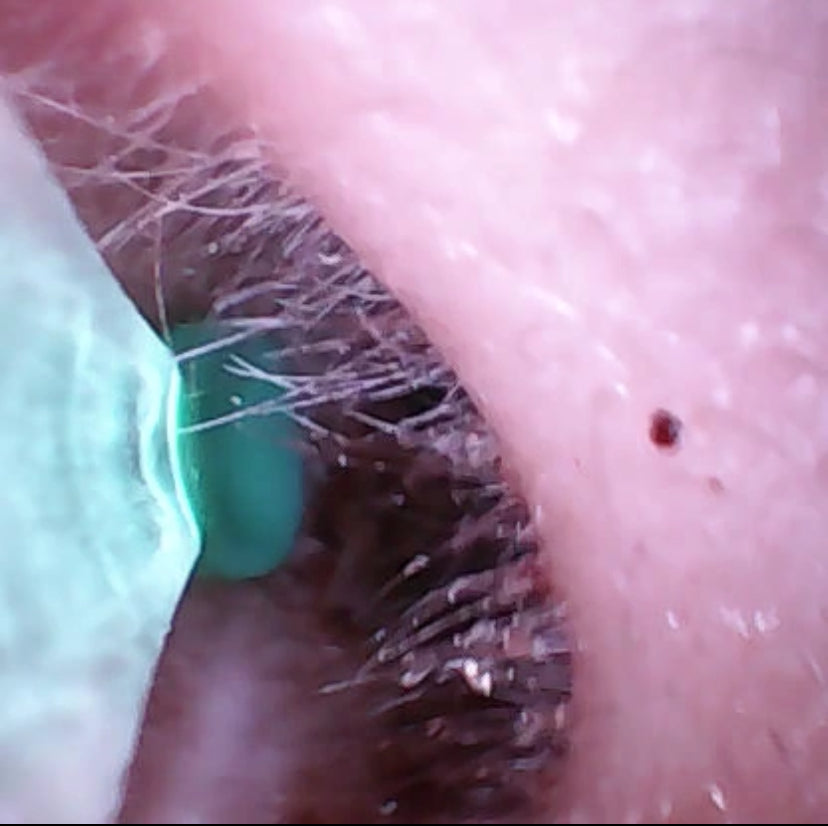 Soniclaire™ Precision Ear Wax Remover Set